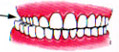 cross bite