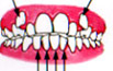 crowding teeth