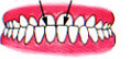 under- bite