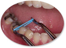 flossing between teeth